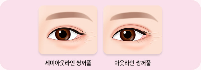 쌍커풀 라인 이미지