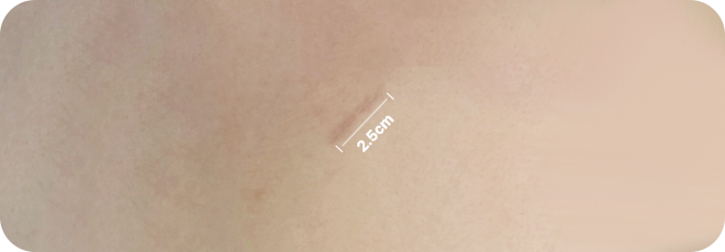 2.5cm