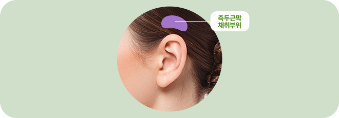 측두근막 채취부위