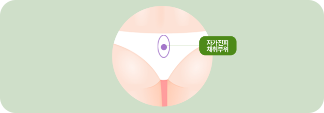 자가진피 채취부위