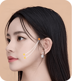 리프팅 방법 이미지