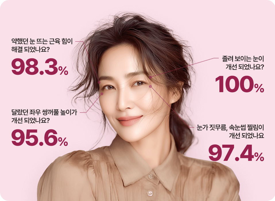 아이디병원 처진눈 솔루션 결과 이미지 