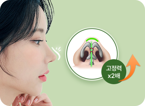 고정력 2배