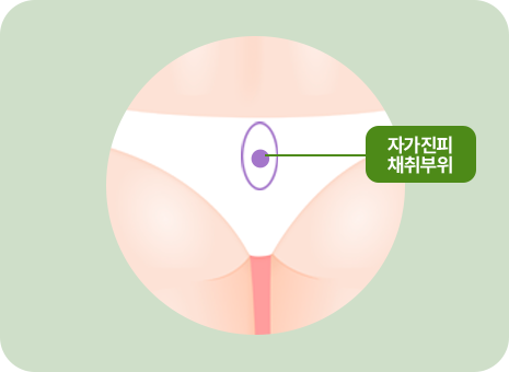 자가진피 채취부위
