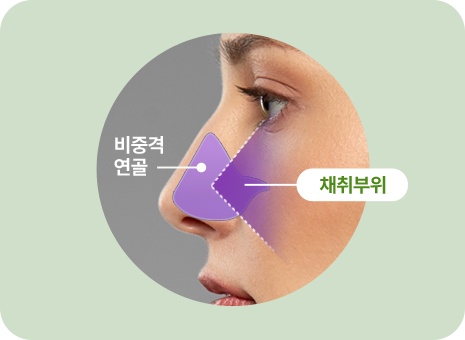 비중격 연골. 채취부위